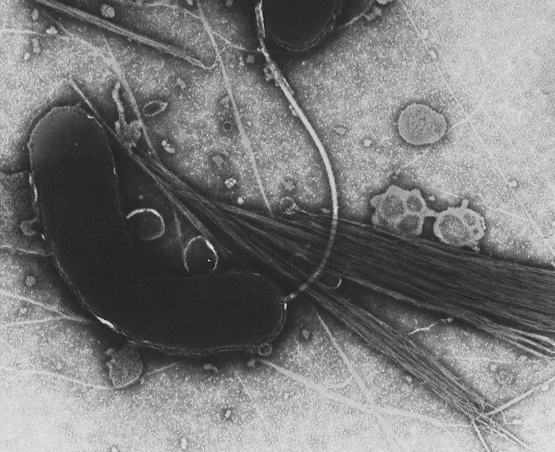 На снимке холерный вибрион, фото: wikipedia.org
