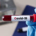 В Запорізькій області — різке зменшення випадків COVID-19