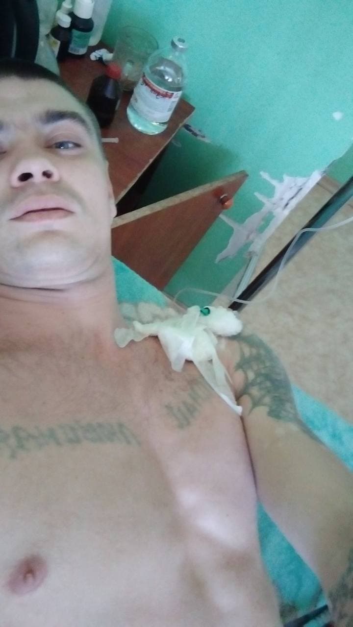 В Запорожье у парня во время операции забыли внутри бинты (фото)